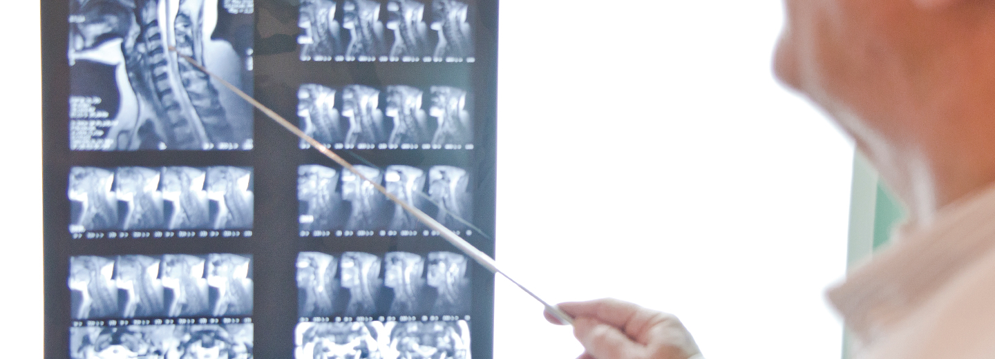 AMIO - Conozca los beneficios de la Ozonoterapia